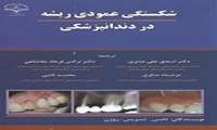 شکستگی عمودی ریشه در دندانپزشکی