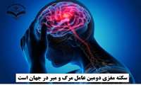 سکته مغزی دومین عامل مرگ و میر در جهان است